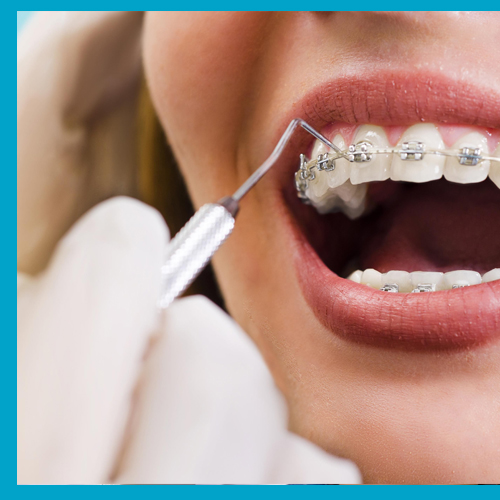 Orthodontics Treatments
